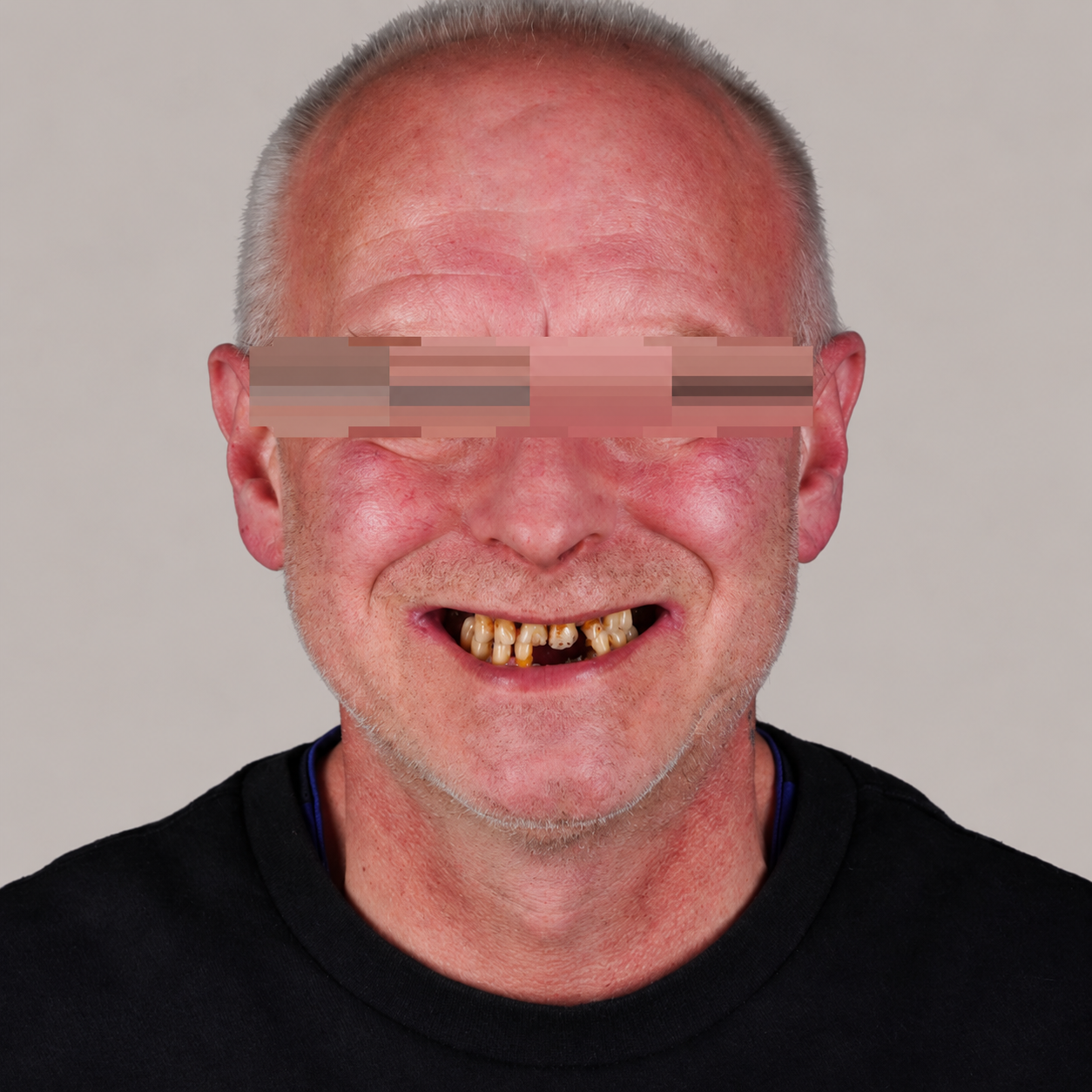 Dentistry before treatment